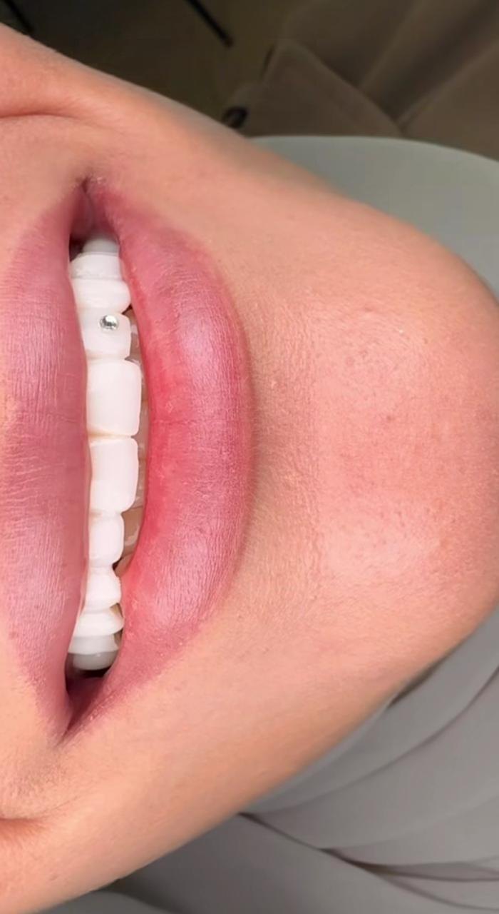 عيادة فاميلي لطب الأسنان — 2